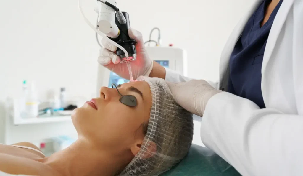 bellingham laser skin resurfacing