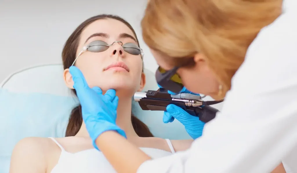 bellingham laser skin resurfacing